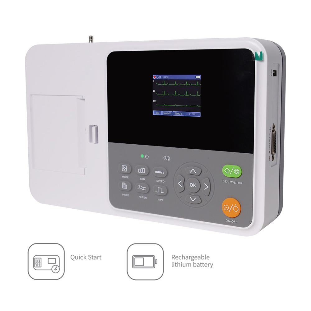 CONTEC E3 ポータブルデジタル3チャンネル12誘導心 - Ekg Ecg Machine Portable のレビューと価格